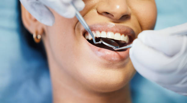 Best Same-Day Emergency Dentist in Lillington, NC