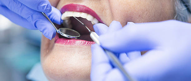 Best Emergency Root Canal Treatment in Lillington, NC